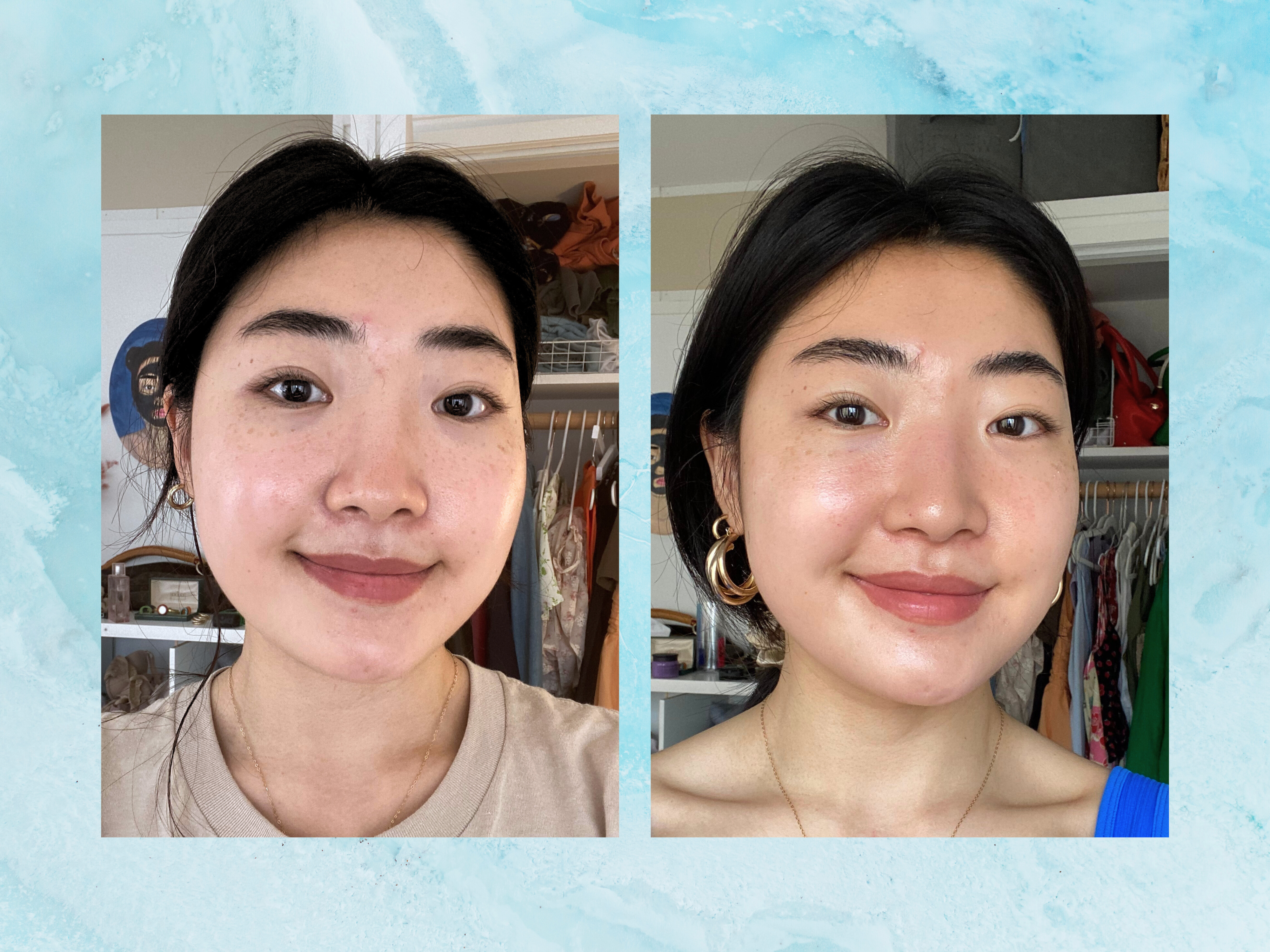 I Tried the Viral HydraFacial for My Ultrasensitive Skin